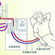 人工肾