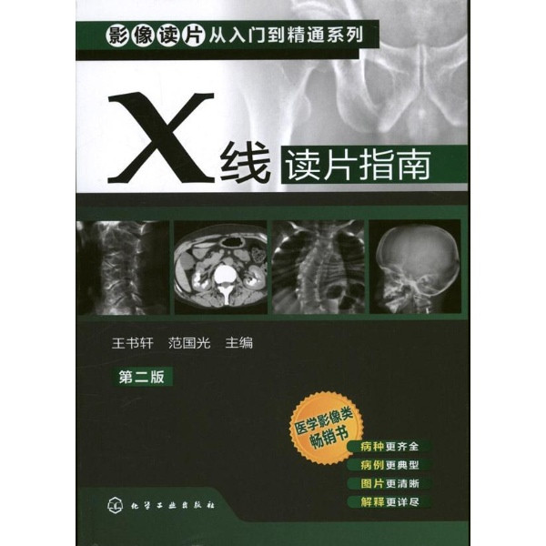 X线读片指南