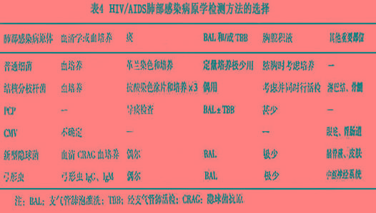 人类免疫缺陷病毒相关呼吸道感染