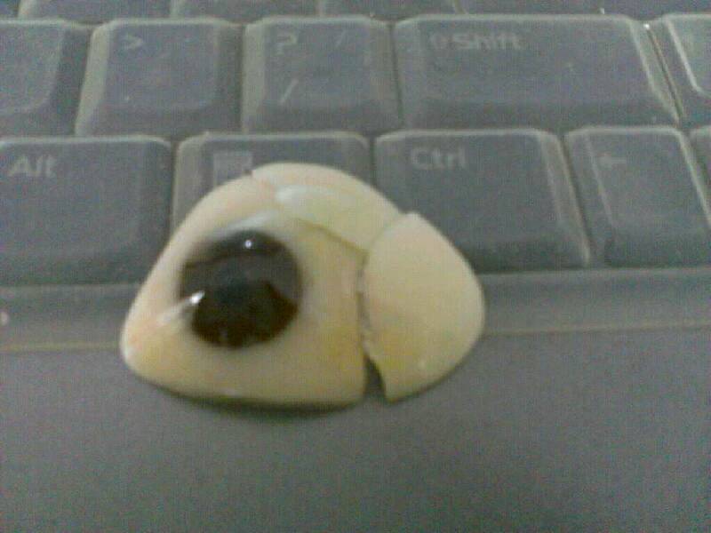 高分子义眼