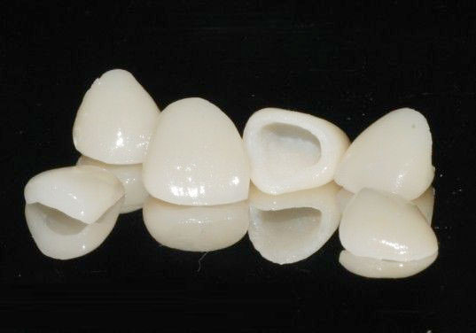 牙冠 牙冠