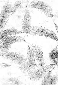 核仁 核仁