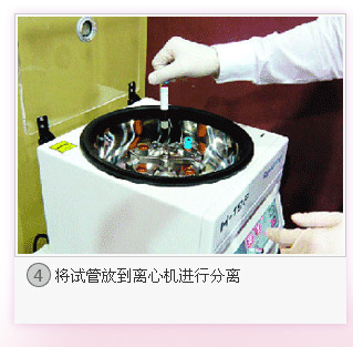 PRP抗衰焕颜