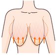 乳房下垂 乳房下垂