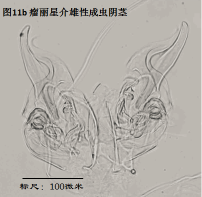 图11b 图11b