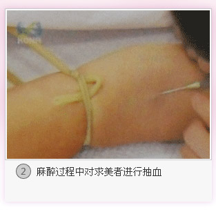 PRP抗衰焕颜
