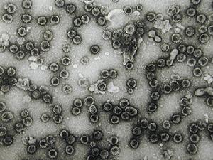 人类乳突病毒 人类乳突病毒