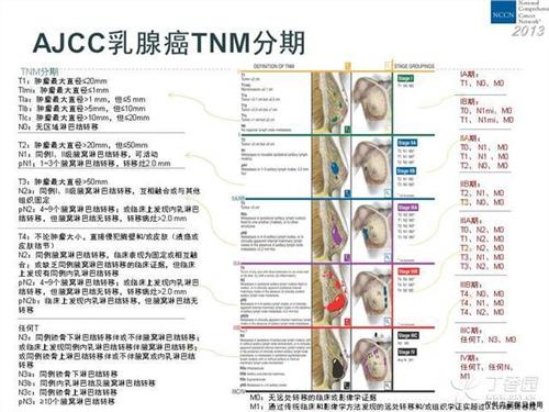 乳腺癌TNM分期 乳腺癌TNM分期