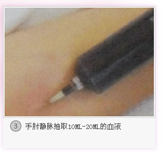 PRP抗衰焕颜