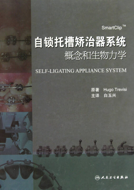 SmartClipTM自锁托槽矫治器系统概念和生物力学