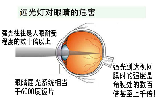 远光灯对眼睛的危害