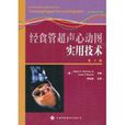 经食管超声心动图实用技术