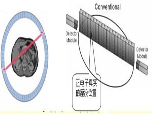 正电子湮没技术