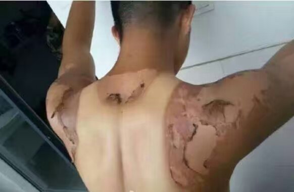 太阳的勋章