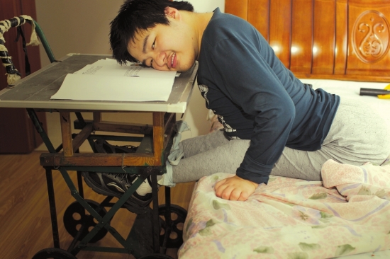 肌无力症 肌无力症