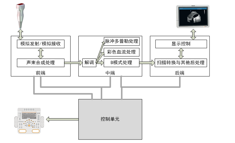 B型超声 B型超声