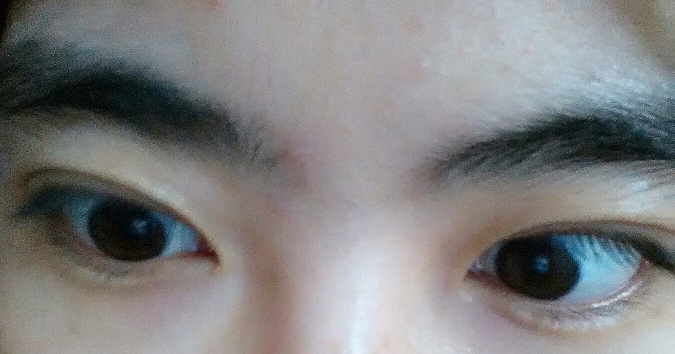 蒙古褶 蒙古褶