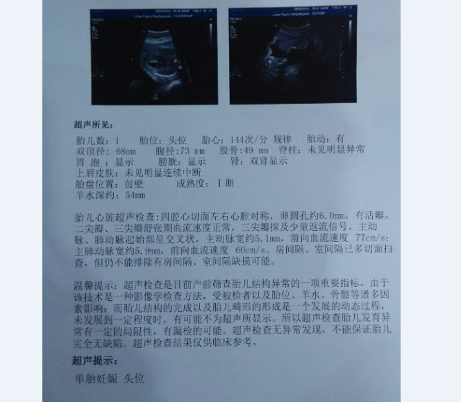 胎儿心脏彩超 胎儿心脏彩超