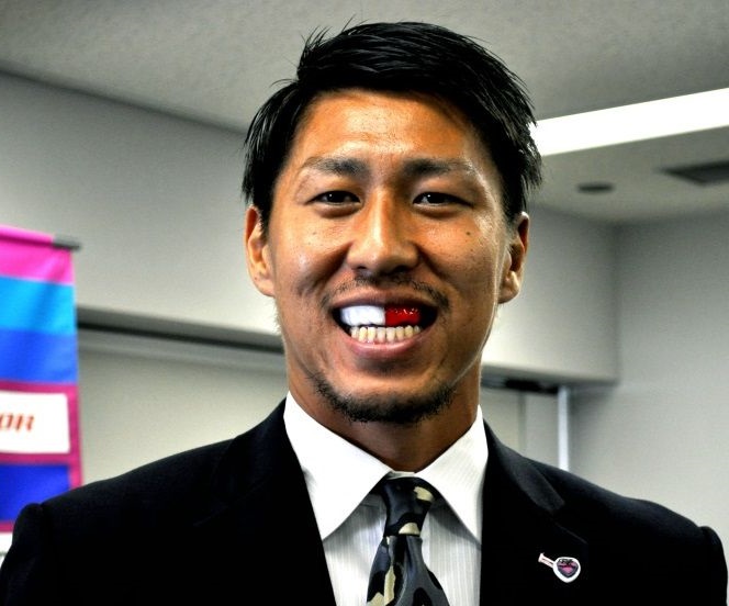 丰田阳平的牙套