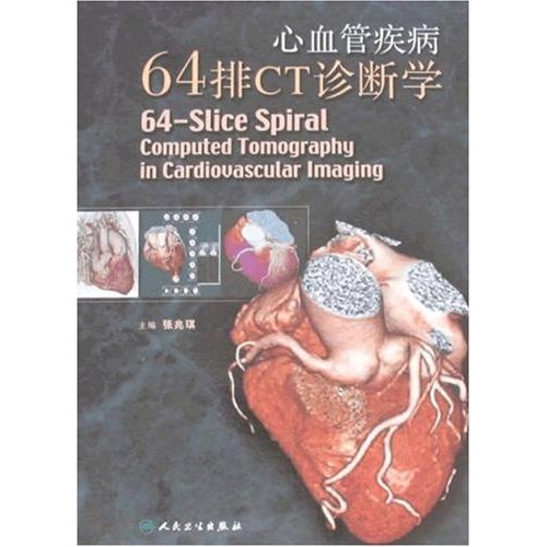 心血管疾病64排CT诊断学 心血管疾病64排CT诊断学