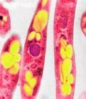 生物武器(用生物杀死有生力量和毁坏植物的武器) 生物武器(用生物杀死有生力量和毁坏植物的武器)