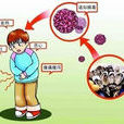 12·25广州81名学生诺如病毒感染事件 12·25广州81名学生诺如病毒感染事件