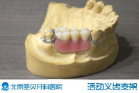 什幺是活动假牙 什幺是活动假牙