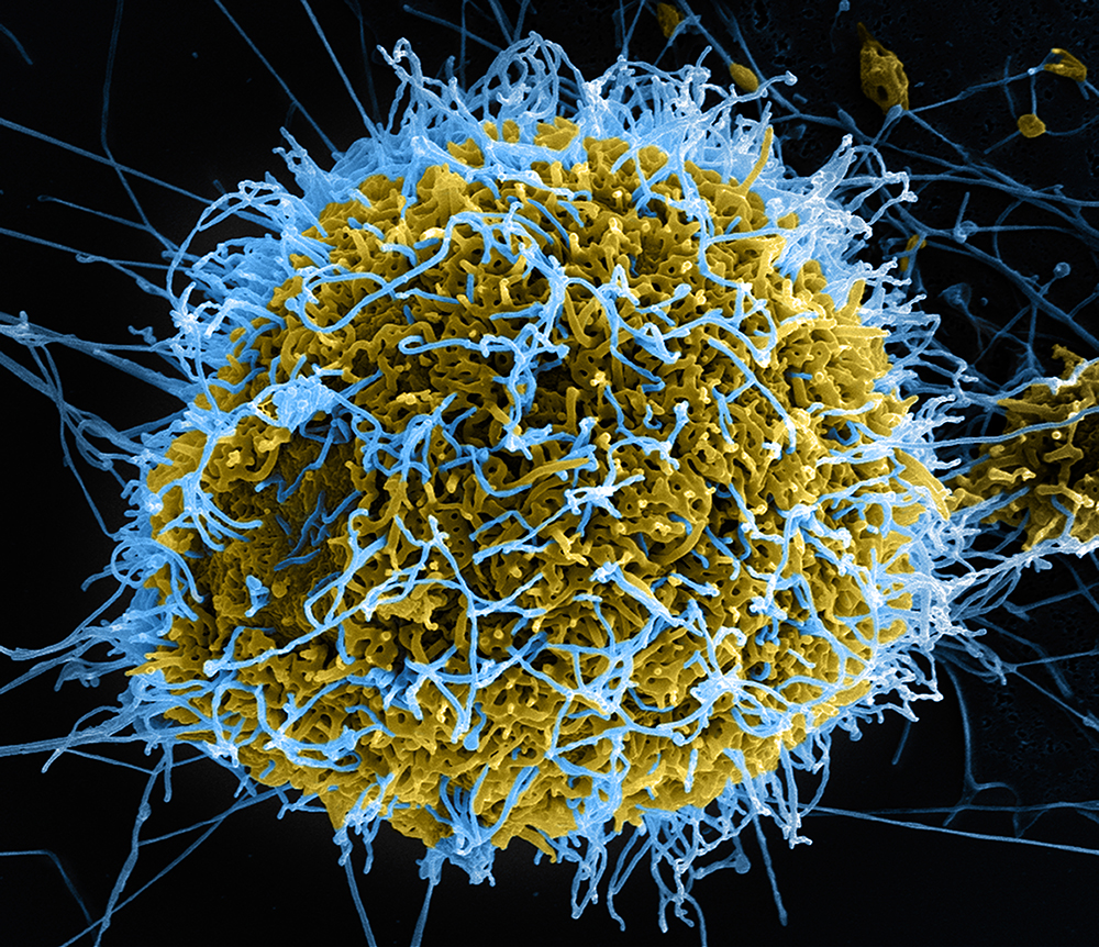 Virus(电脑病毒) Virus(电脑病毒)